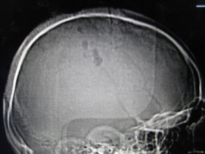 Photo 8 brain scan
