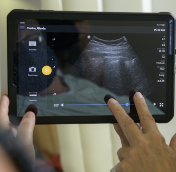 Point of care lung ultrasound