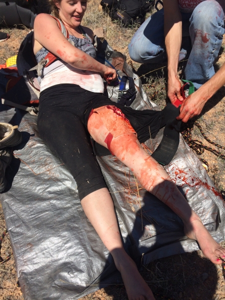 Wilderness medicine student with simulated injury